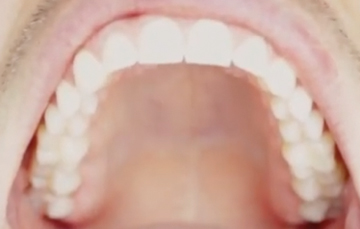 Top Inside View of Teeth