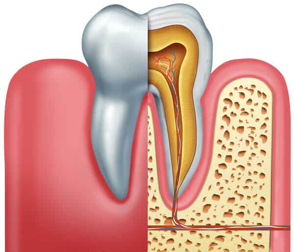 Why is root canal treatment needed?